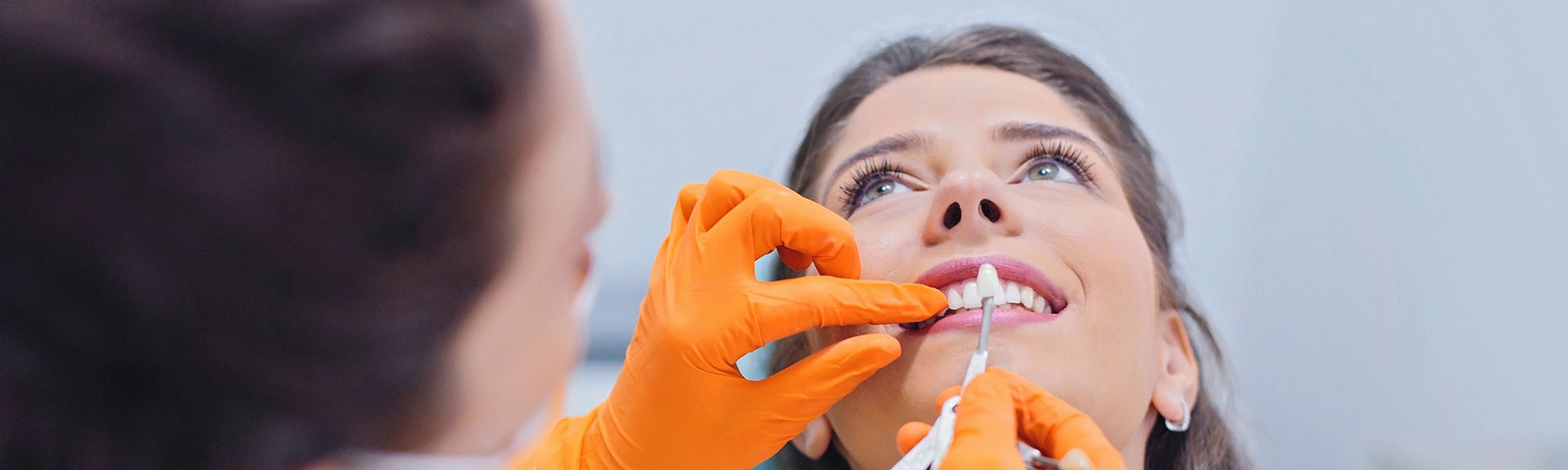 Everything You Need to Know About Porcelain Veneers Blog Image