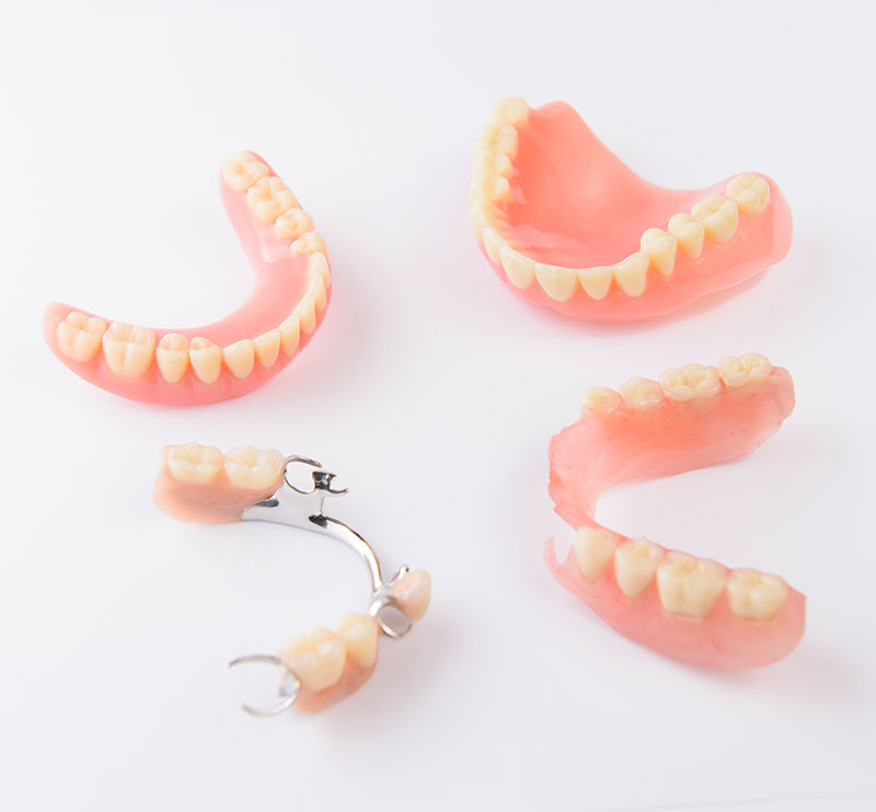 Partial Dentures Santa Barbara CA