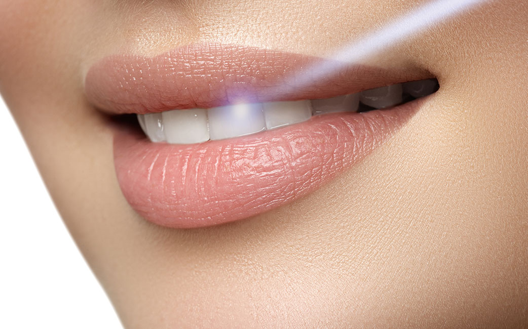Dental Lasers Santa Barbara CA